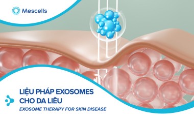 Exosomes của tế bào gốc trung mô có nguồn gốc từ dây rốn kết hợp với Pluronic F127 Hydrogel thúc đẩy quá trình chữa lành vết thương do bệnh tiểu đường mãn tính và tái tạo da hoàn chỉnh