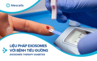 Exosomes tế bào gốc trung mô có thể là một chiến lược mới để điều trị các biến chứng của bệnh tiểu đường