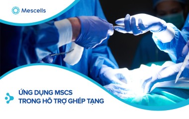 Ứng dụng Tế Bào Gốc Trung Mô (MSCs) trong hỗ trợ ghép tạng