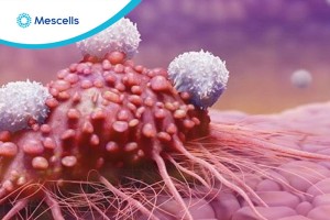 Tế bào NK và liệu pháp tế bào NK điều trị ung thư
