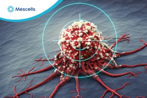 Tế bào NK kết hợp với kháng thể đặc hiệu kép có tiềm năng chống lại khối u ở ung thư hạch