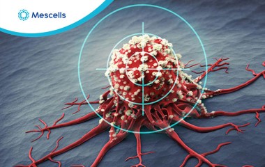 Tế bào NK kết hợp với kháng thể đặc hiệu kép có tiềm năng chống lại khối u ở ung thư hạch