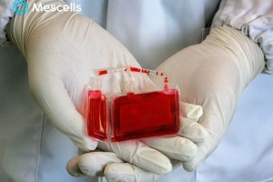Lấy tế bào gốc máu cuống rốn: Những điều bạn cần biết