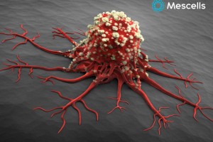 Tế bào gốc ung thư - Ứng dụng tiềm năng chống trị bệnh ung thư