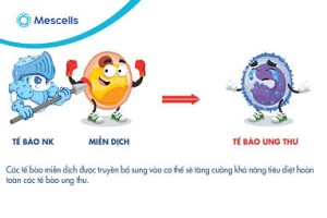 Tìm hiểu về xét nghiệm tế bào NK
