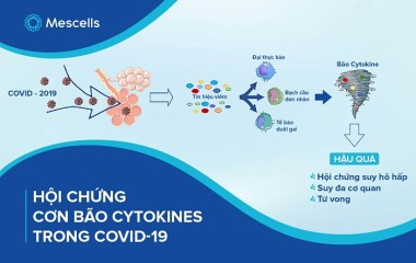 Hội chứng cơn bão Cytokines trong Covid-19