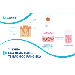 Ý nghĩa của ngân hàng tế bào gốc răng sữa là gì? Lợi ích