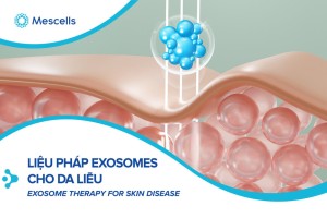 Exosomes của tế bào gốc trung mô có nguồn gốc từ dây rốn kết hợp với Pluronic F127 Hydrogel thúc đẩy quá trình chữa lành vết thương do bệnh tiểu đường mãn tính và tái tạo da hoàn chỉnh