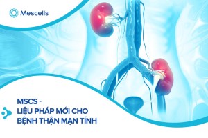 Use of mesenchymal stem cells for chronic kidney disease