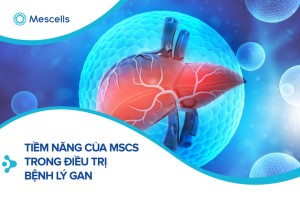 The Application of Mesenchymal Stem Cells in the Treatment of Liver Diseases: Mechanism, Efficacy, and Safety Issues