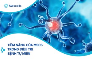 The therapeutic applications of mesenchymal stromal cells from human perinatal tissues in autoimmune diseases