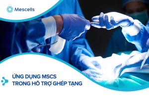 Ứng dụng Tế Bào Gốc Trung Mô (MSCs) trong hỗ trợ ghép tạng