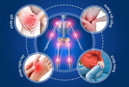 Tìm hiểu về bệnh lý cơ xương khớp