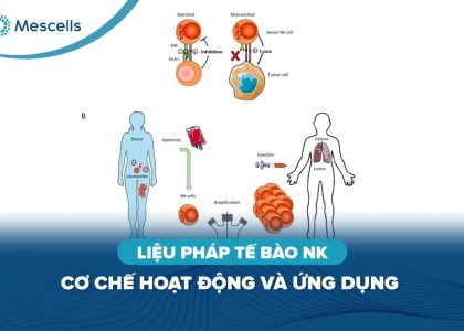 Liệu pháp tế bào nk-01