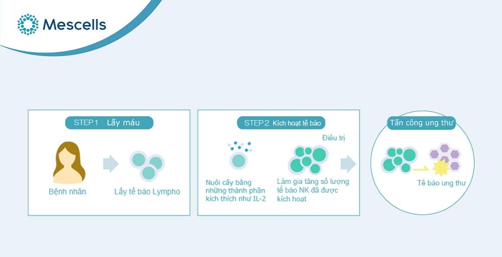 Liệu pháp tế bào nk-04