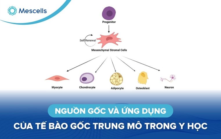 Nguồn gốc và ứng dụng của tế bào gốc trung mô-01