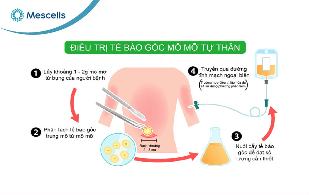 Tế bào gốc chữa được bệnh gì-07