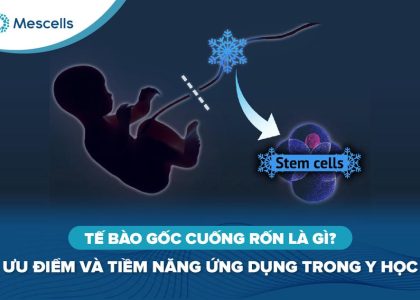 Tế bào gốc cuống rốn-01