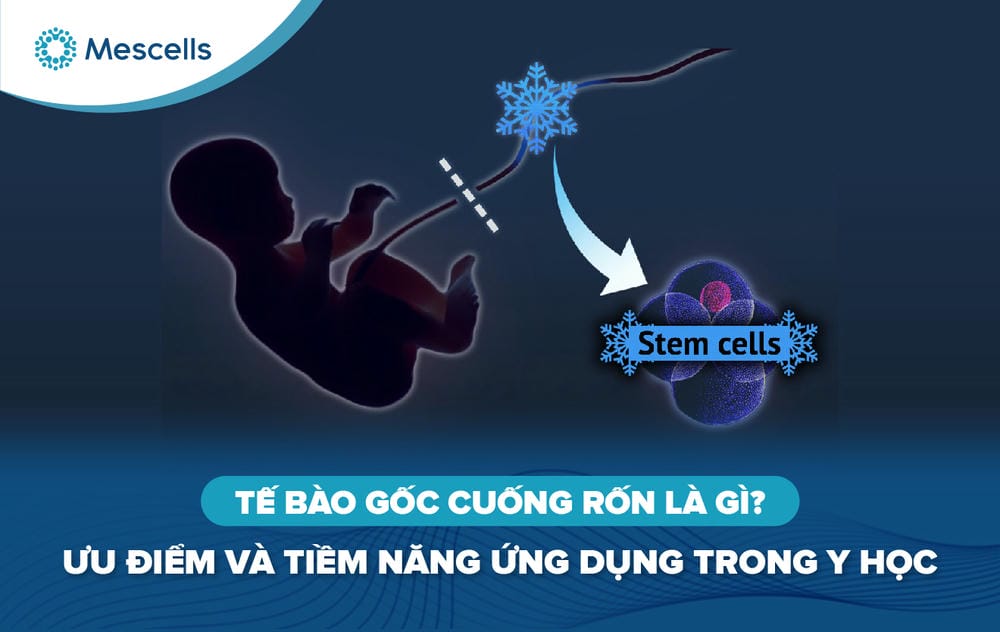 Tế bào gốc cuống rốn-01