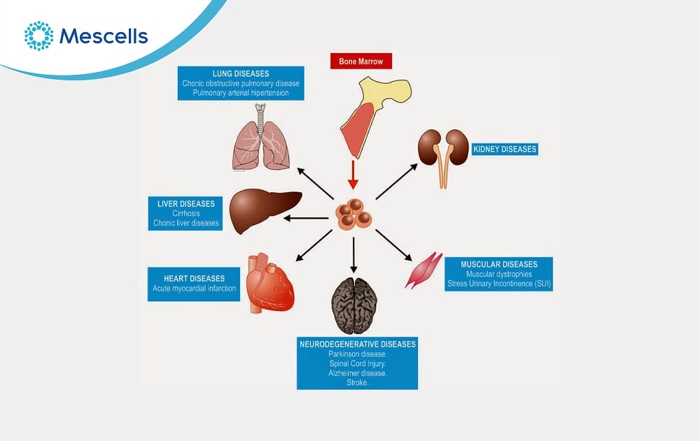 Tế bào gốc tủy xương-04