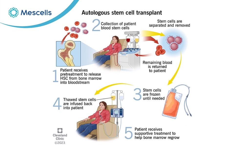 Tế bào gốc tủy xương-05