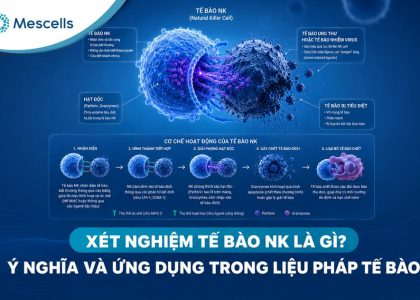 Xét nghiệm tế bào NK-01
