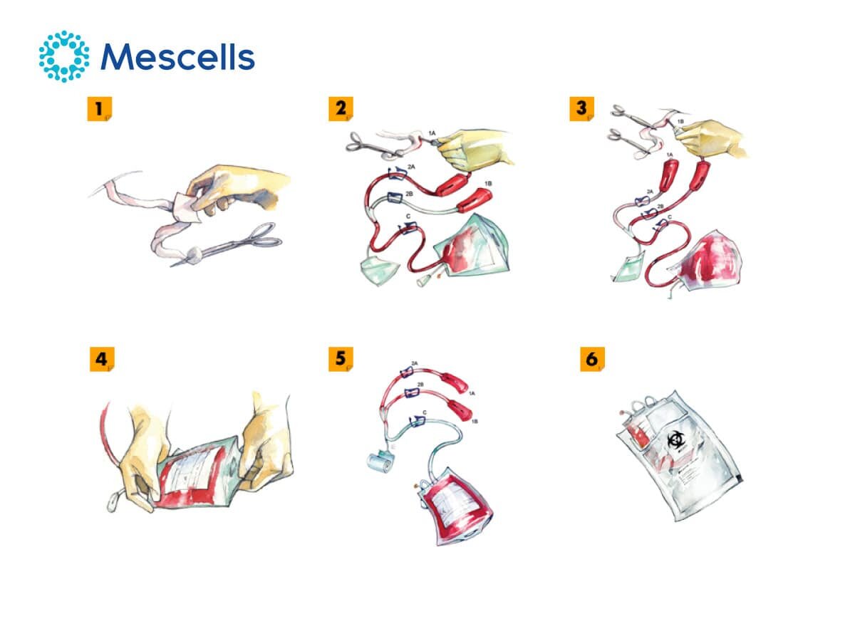 te-bao-goc-mau-cuong-ron-3