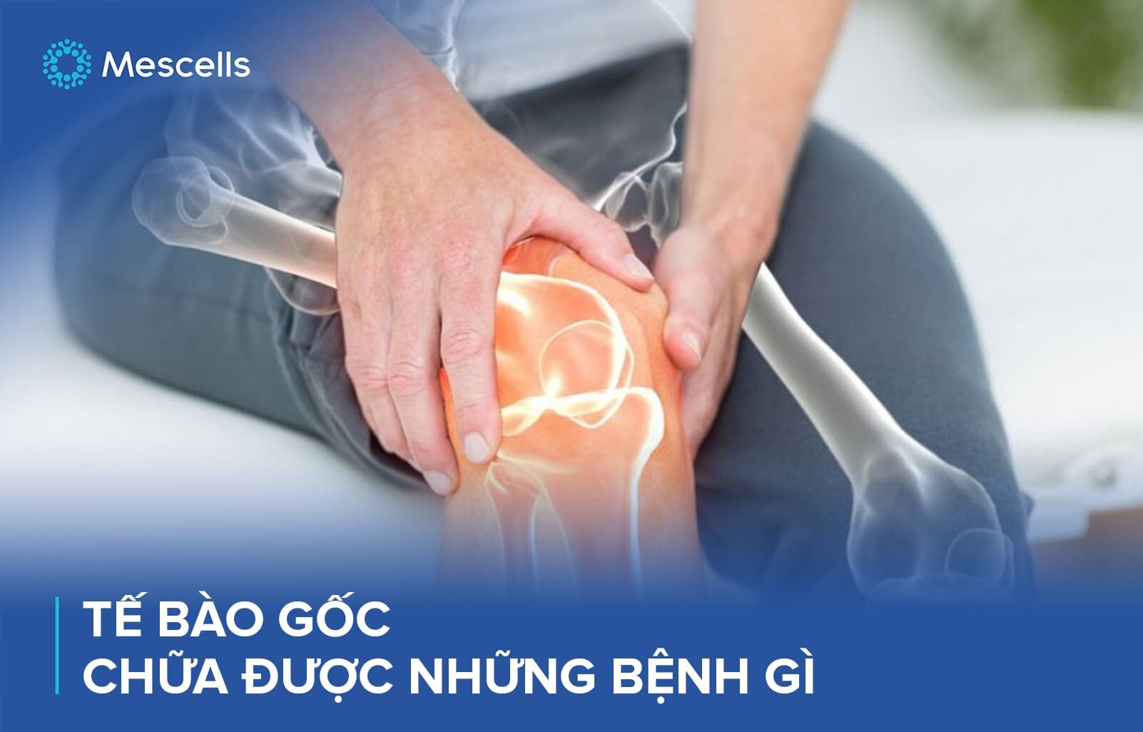 te-bao-goc-chua-duoc-nhung-benh-gi-2