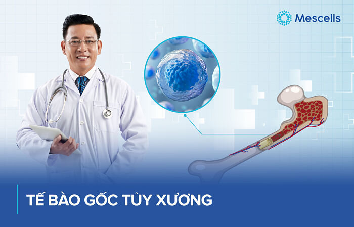 te-bao-goc-lay-tu-dau-1