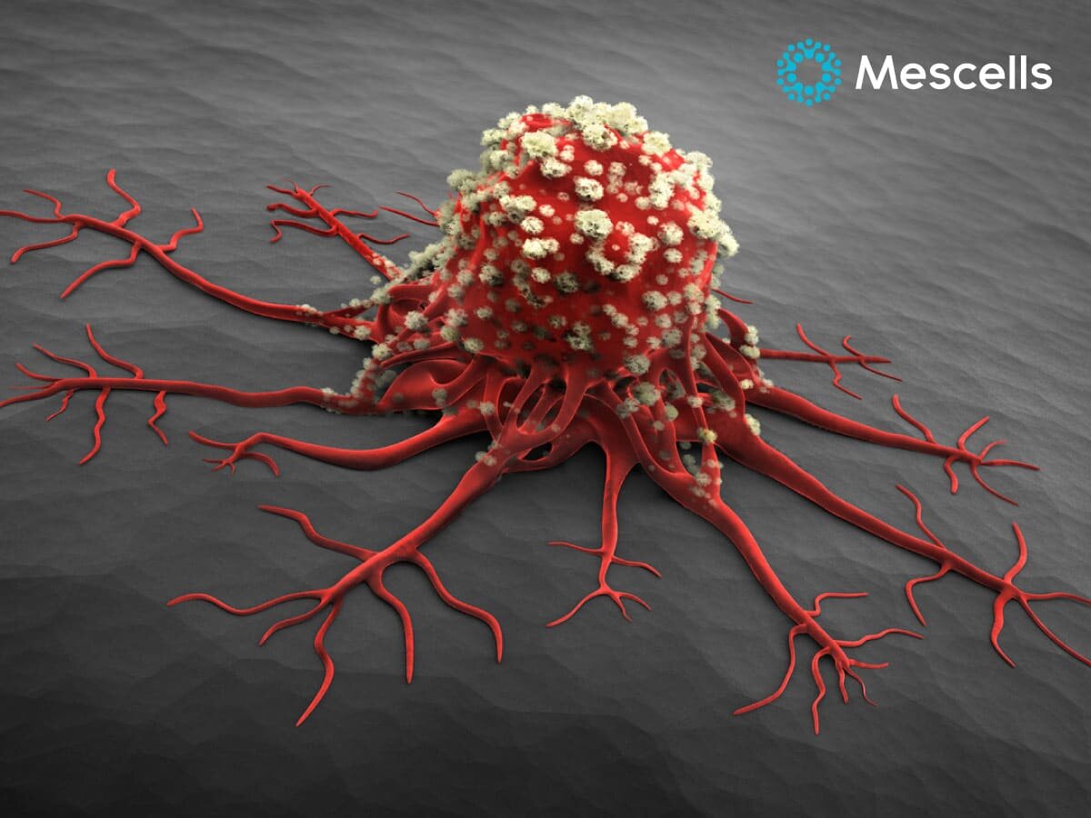 te-bao-goc-ung-thu-1