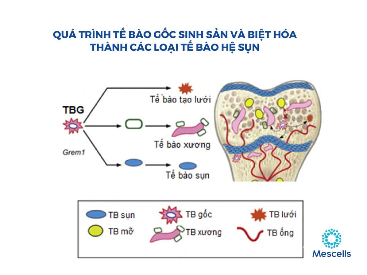 dieu-tri-co-xuong-khop-bang-te-bao-goc-1