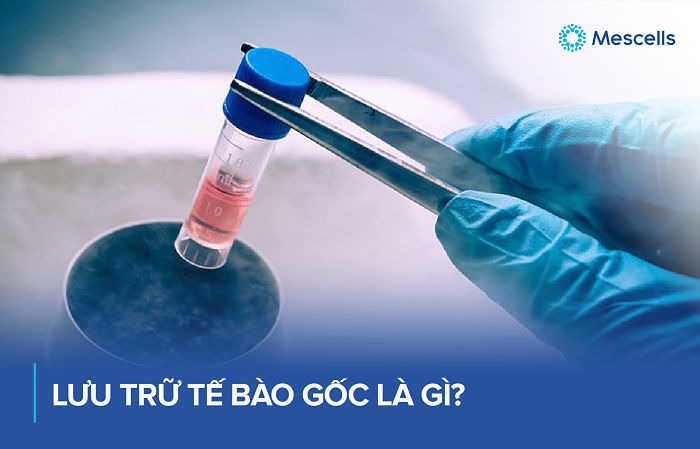 luu-tru-te-bao-goc-1