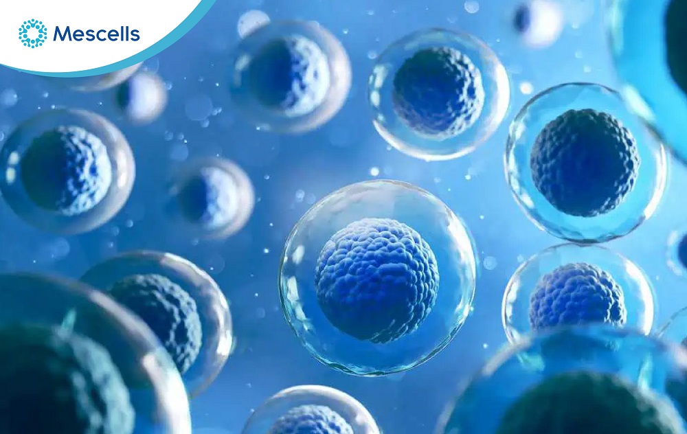 Liệu pháp tế bào gốc-02