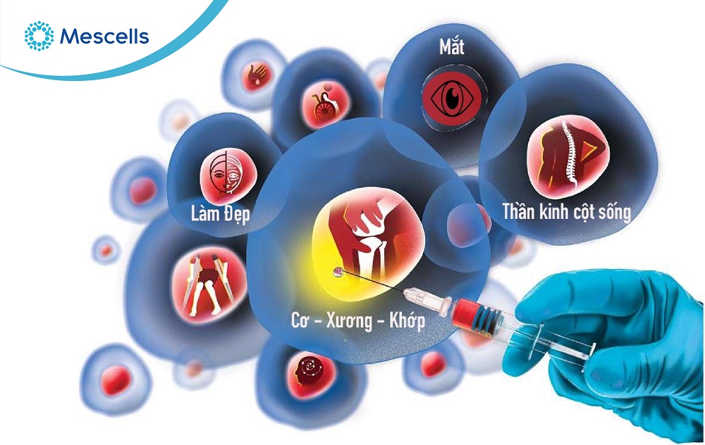 Liệu pháp tế bào gốc-03