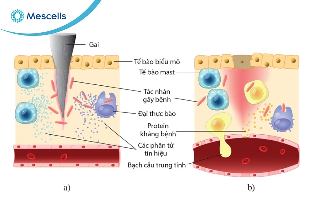 Miễn dịch không đặc hiệu là gì-03