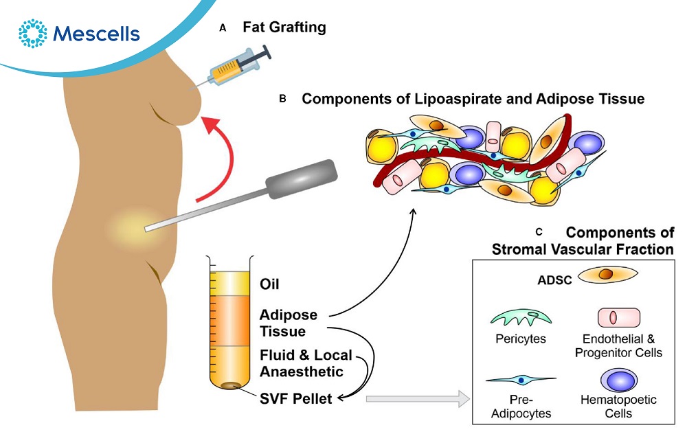 Tế bào gốc mô mỡ và các ứng dụng lâm sàng-02