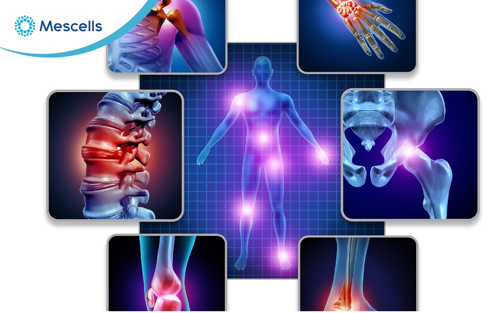 Tế bào gốc trưởng thành-05