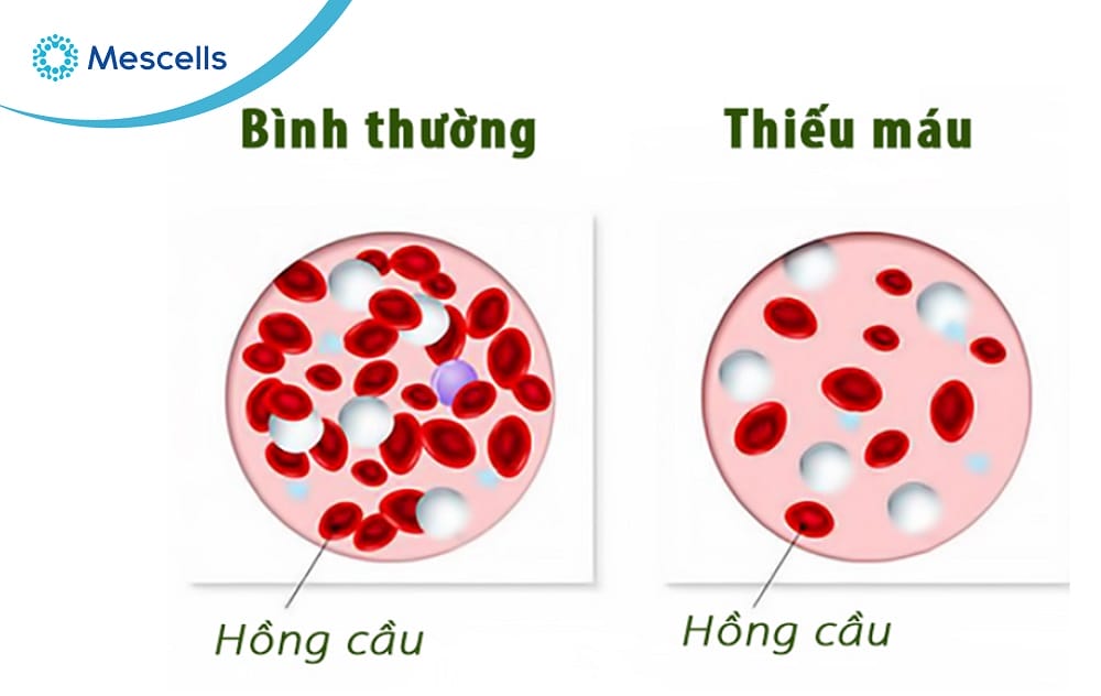 Tế bào máu Những điều cần biết-05