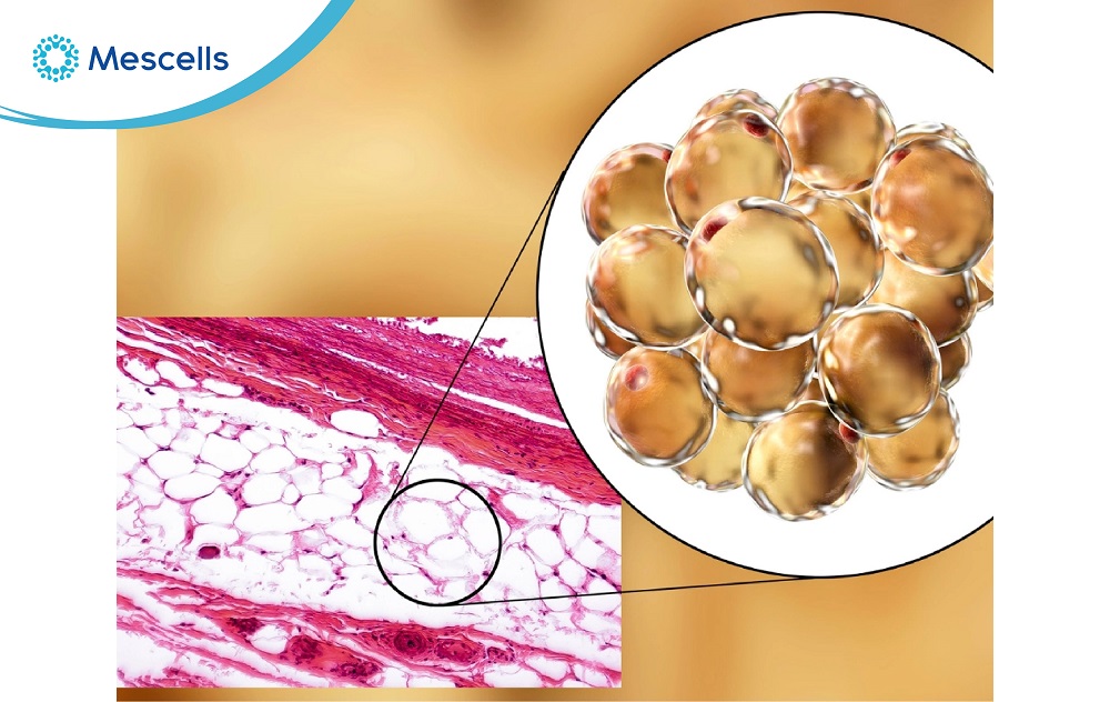 Tổng quan về tế bào mỡ-06