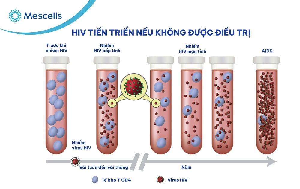 suy giảm miễn dịch-04
