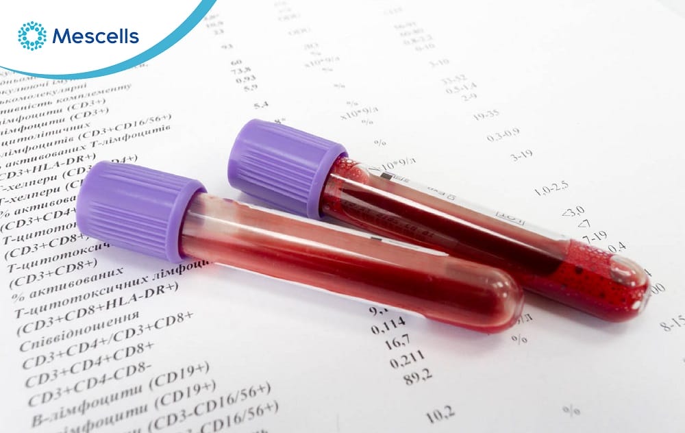 suy giảm miễn dịch-06