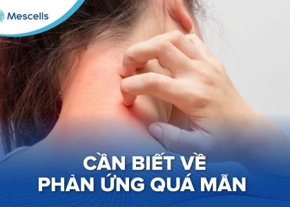 Phản ứng quá mẫn-01