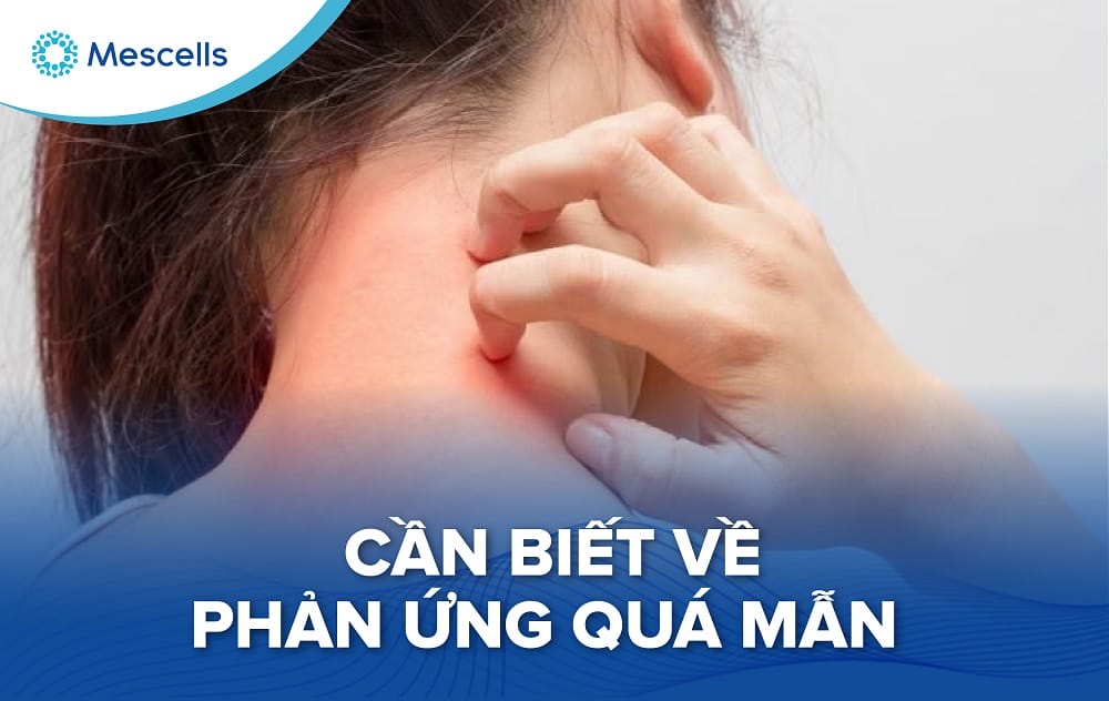 Phản ứng quá mẫn-01