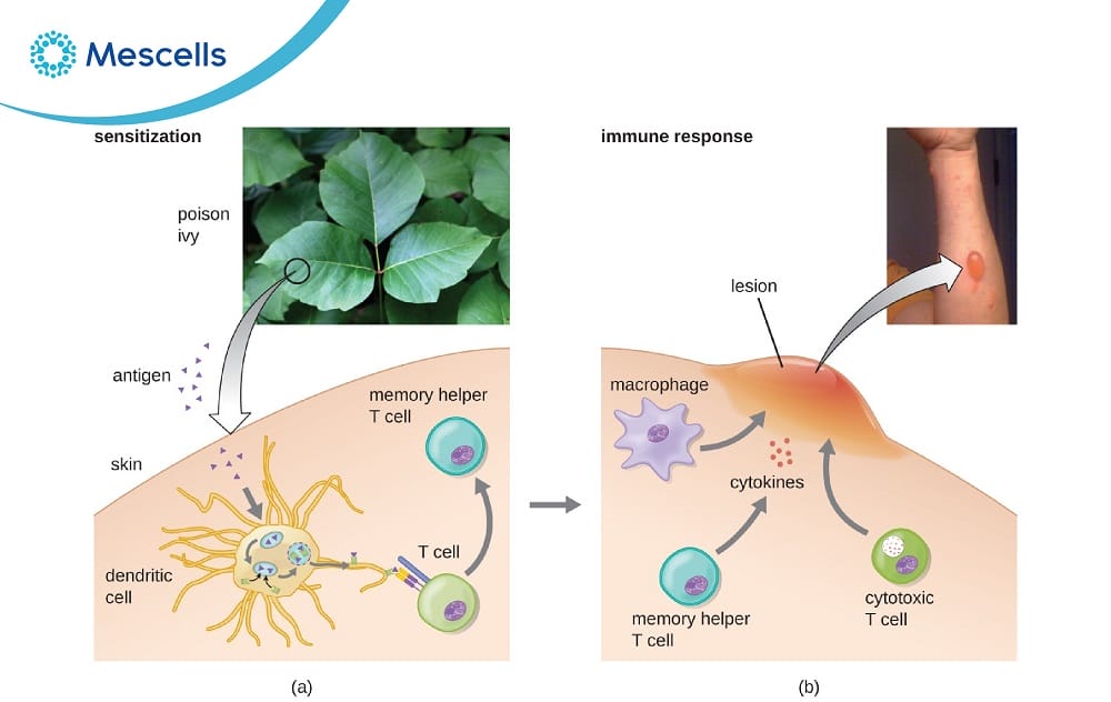 Phản ứng quá mẫn-02