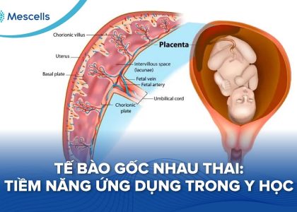 Tế bào gốc nhau thai-01