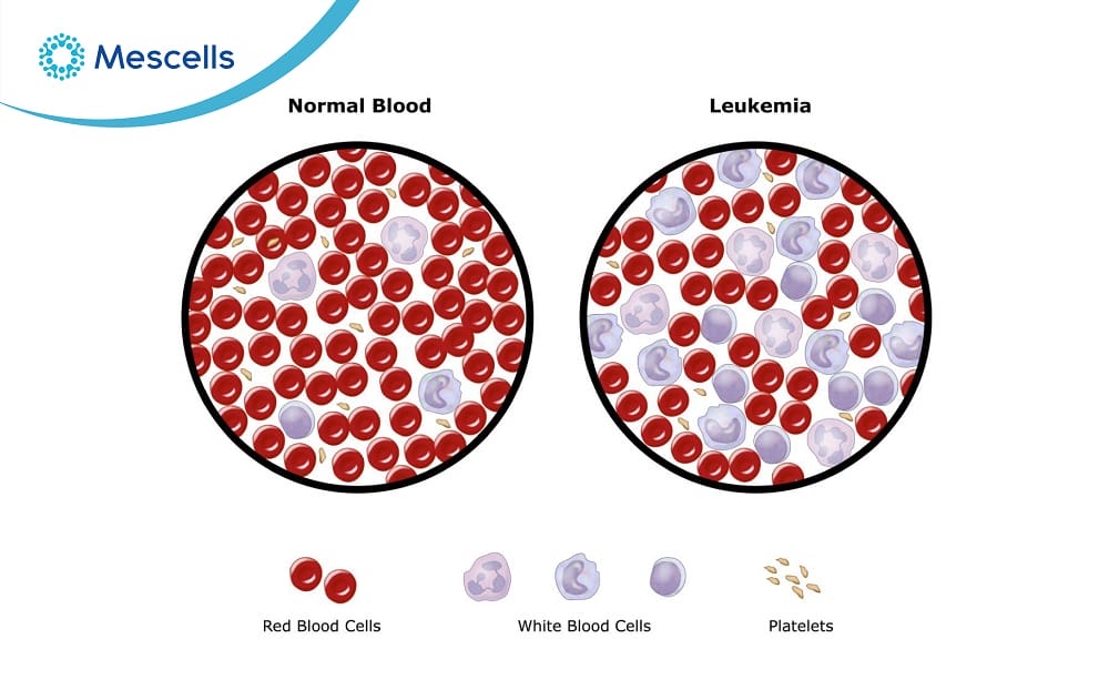 Bạch cầu là gì-05