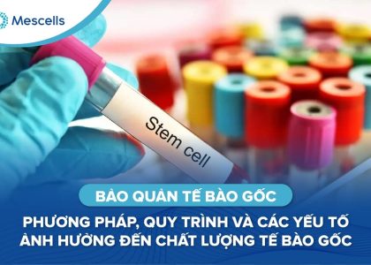 Bảo quản tế bào gốc