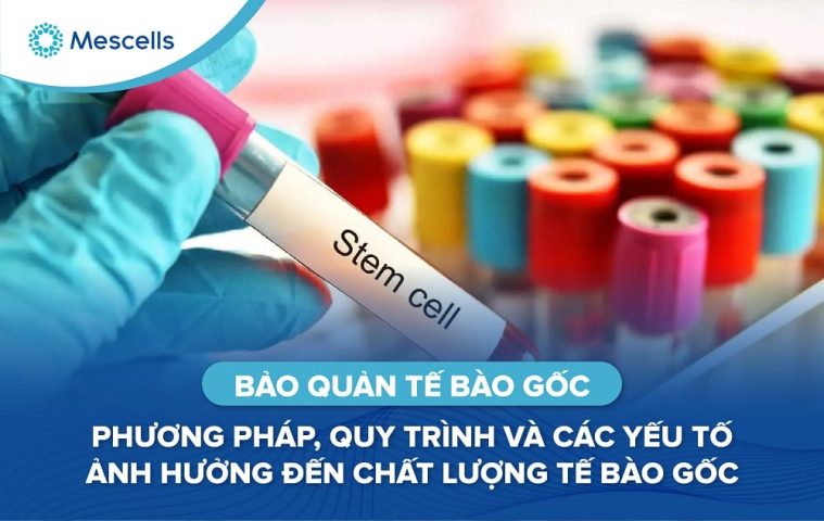 Bảo quản tế bào gốc