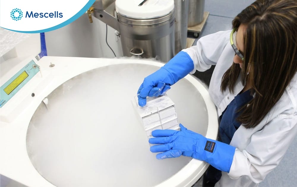 Bảo quản tế bào gốc