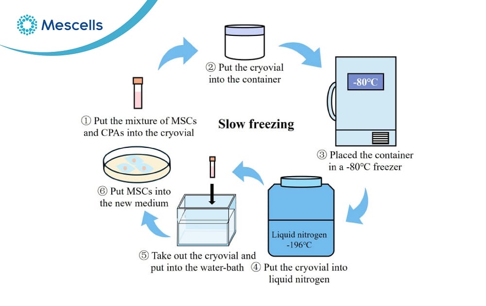 Bảo quản tế bào gốc